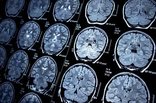 レントゲン、CT、MRI等の医療系AI開発のための機械学習データセット